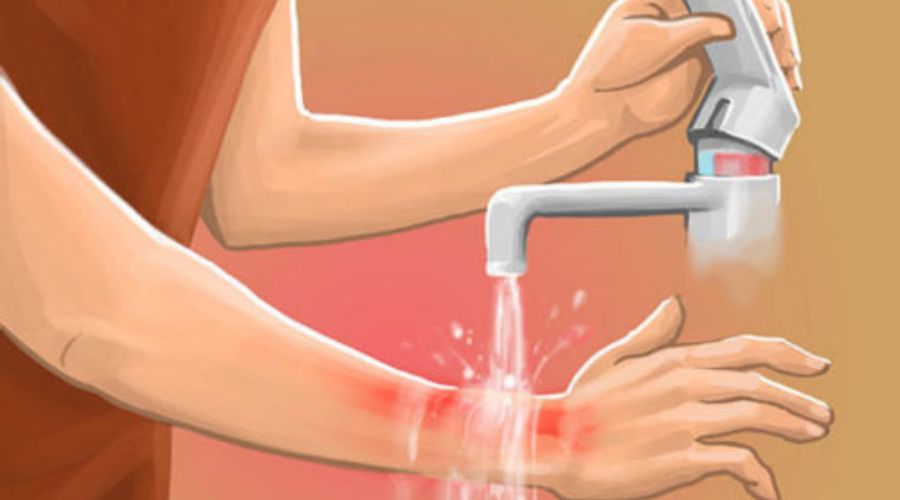 NH4OH có thể gây bỏng da khi tiếp xúc