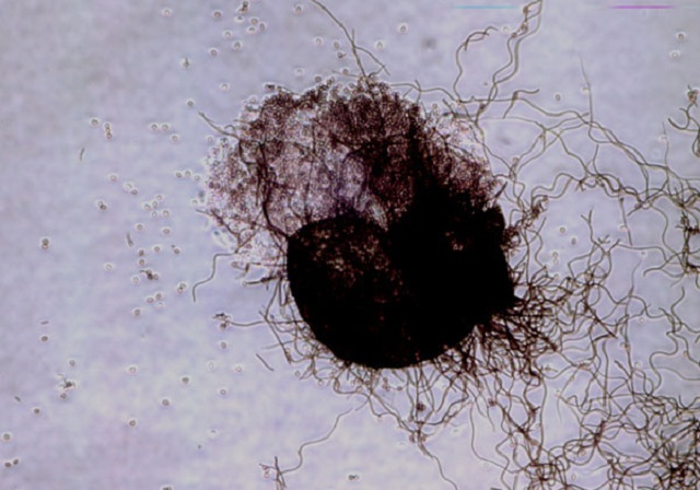 Hình ảnh nấm mốc Chaetomium